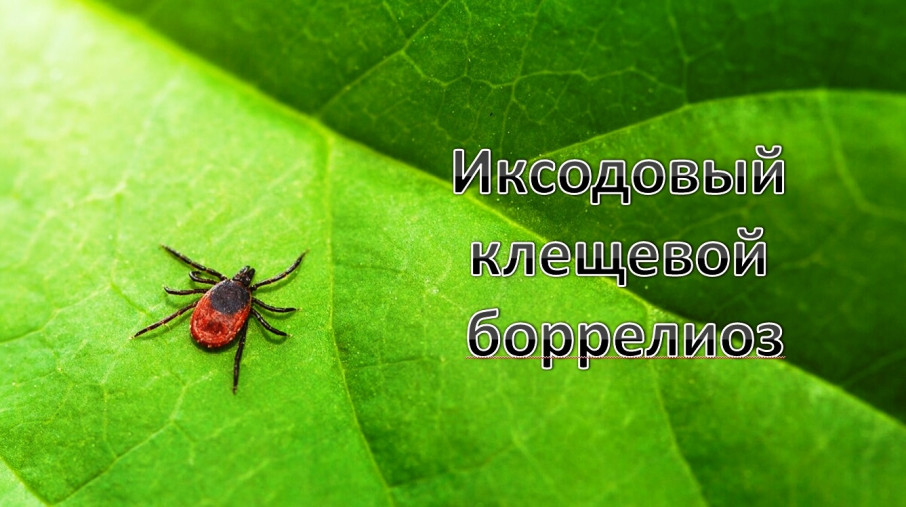 Иксодовый клещевой боррелиоз Иксодовый клещевой боррелиоз.